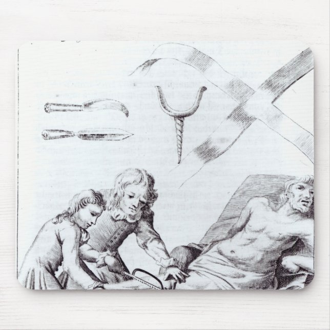 Alfombrilla De Ratón Operación quirúrgica para amputar una pierna (Frente)