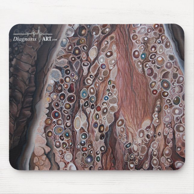 Alfombrilla De Ratón "Sensación: Ganglio de raíz dorsal " (Frente)