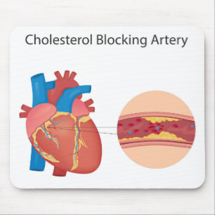 Alfombrilla De Ratón Vómitos sanguíneos estrechos