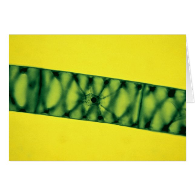 Alga verde Spirogyra (Anverso (Horizontal))