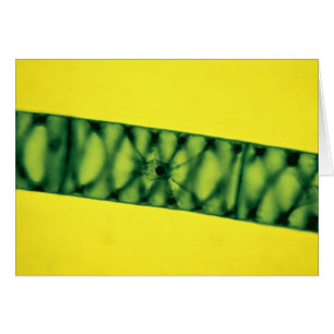 Algas verdes de Spirogyra