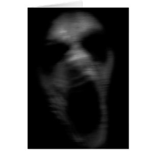 Alteraciones mentales de caída