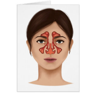 Anatomía De Sinuses Nasales