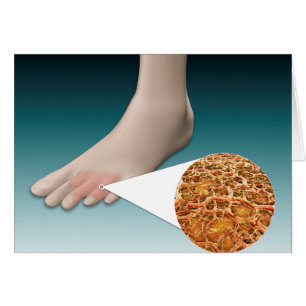 Anatomía del hongo de pie con el primer