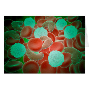 Anemia De Células Negras Con Glóbulos Rojos