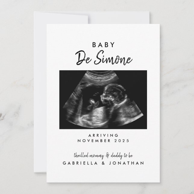 Anuncio  Black White Typography Sonogram Photo Pregnancy (Anverso)