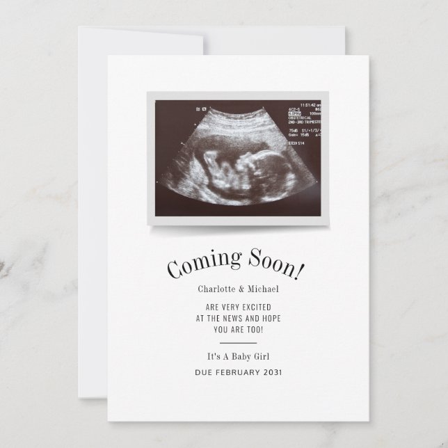 Anuncio Coming Soon Ultrasound Photo Scan Baby Reveal (Anverso)