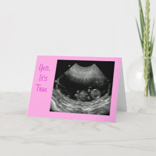 Anuncio Rosa de recién nacido