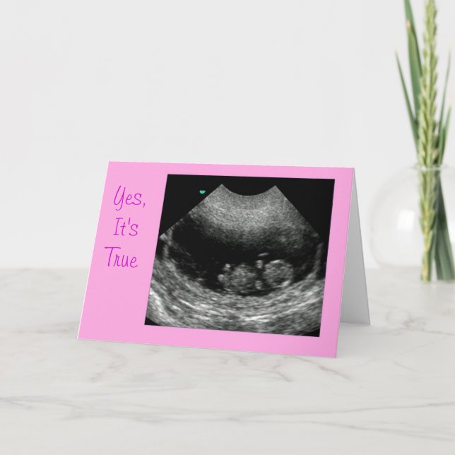 Anuncio Rosa de recién nacido (Anverso)