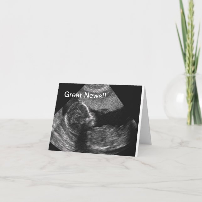 Anuncio Ultrasonido del recién nacido (Anverso)