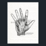 Arte de anatomía vintage La palma de la mano<br><div class="desc">Este ilustracion de anatomía en blanco y negro presenta músculos de la palma de la mano.</div>