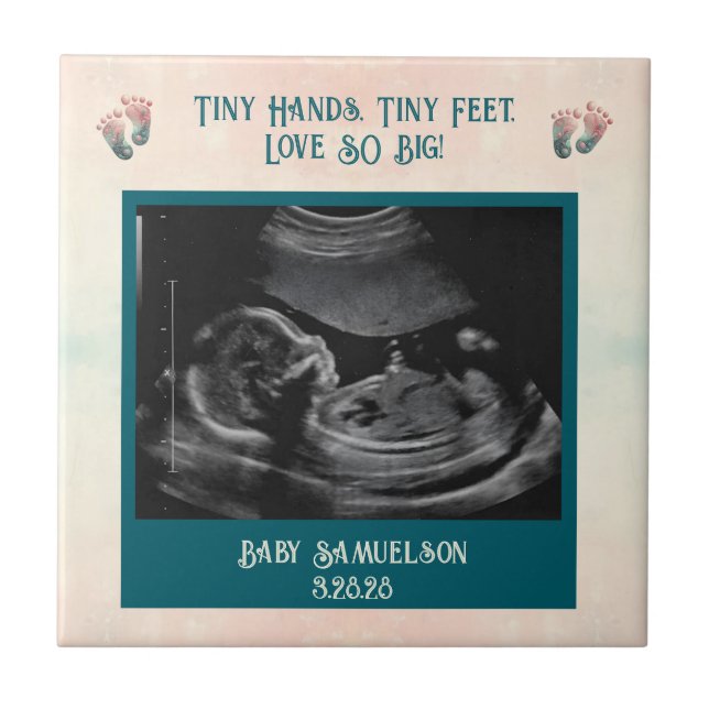 Azulejo Bebé Ultrasonido Keepsake Gibox (Frente)