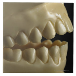 Azulejo De Cerámica Un modelo dental
