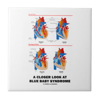 Azulejo Una mirada más atenta en la anatomía del corazón
