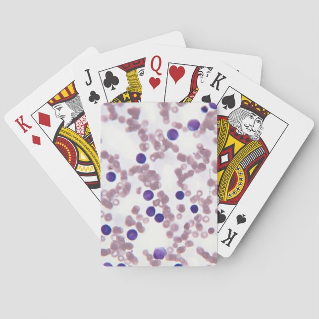 Baraja De Cartas Células linfocitarias neoplásicas (Reverso)