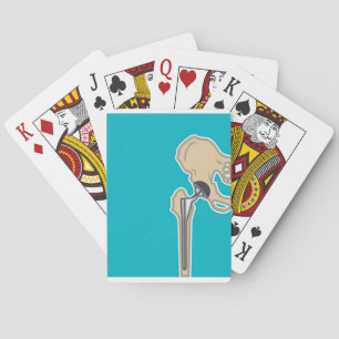 Baraja De Cartas Hip Joint Replacement