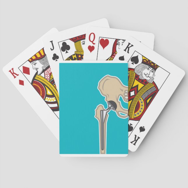 Baraja De Cartas Hip Joint Replacement (Reverso)