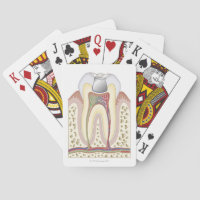 Ilustracion del relleno dental