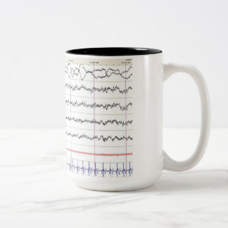 Bicolor Taza de EEG - sueño del REM