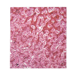Bloc De Notas Células de hígado humanas con el cáncer