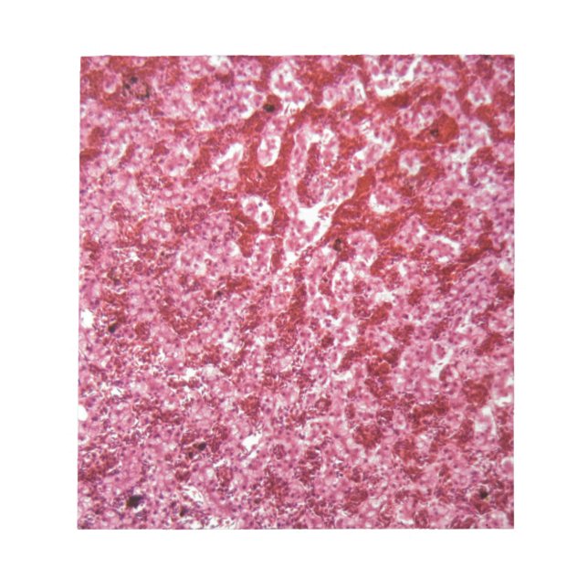 Bloc De Notas Células hepáticas humanas con cáncer (Frente)