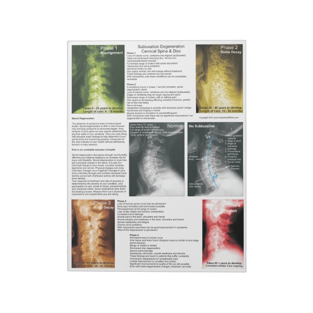 Bloc De Notas Degeneración cervical por subluxación de almohadil (Lado Izquierdo)