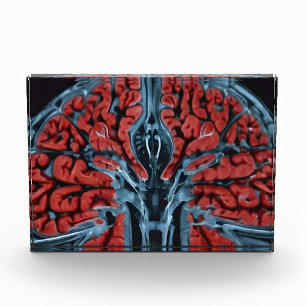 Bloque Para Fotos Revisión cerebral por resonancia magnética