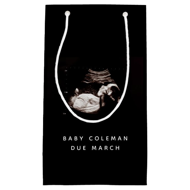 Bolsa De Regalo Pequeña Sonograma ecografía del bebé embarazada (Anverso)