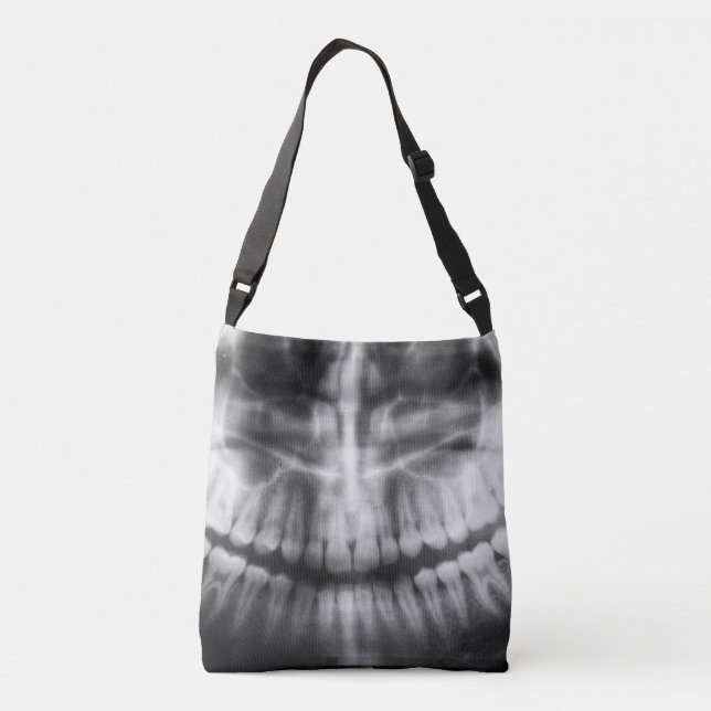 Bolso Cruzado Rayos X de dientes sonríen blanco y negro (Reverso)