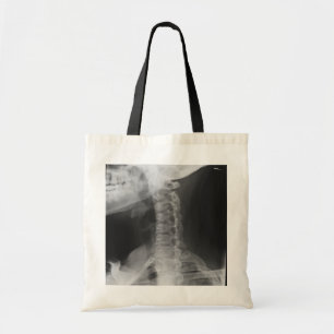 Bolso De Tela 2 radiografiados