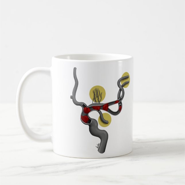 Café Taza de Arteria Cerebral Media (Izquierda)