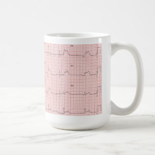 Café Taza de ECG