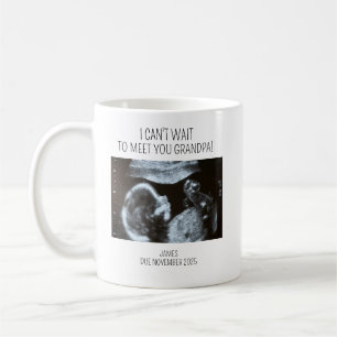 Café Taza de ultrasonido, sonograma de bebé, regalos pe