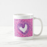 Café Taza del amor de la histología<br><div class="desc">Corazón en células,  taza del tejido de la próstata del amor</div>