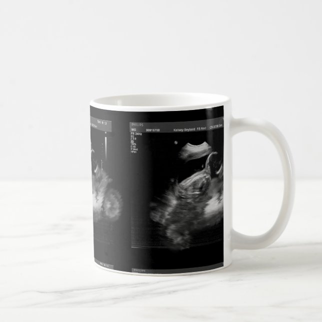 Café Taza del Sonogram de la motocicleta (Derecha)