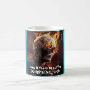 Café Taza occipital de la neuralgia