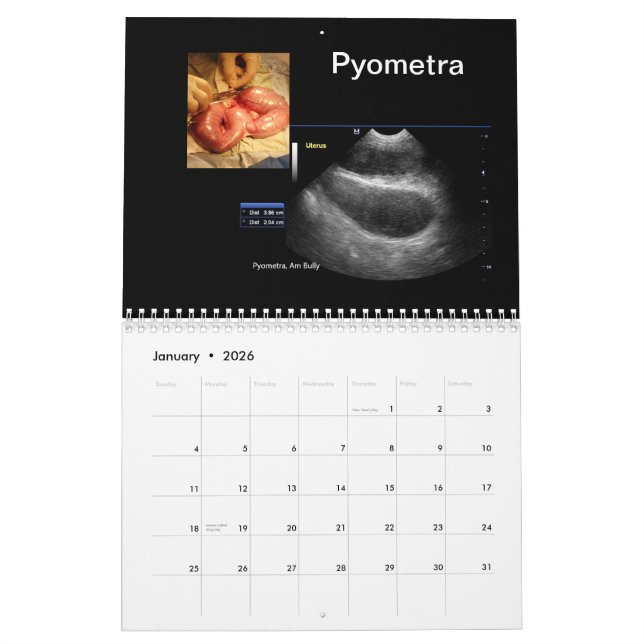 Calendario de imágenes de ultrasonido (Jan 2026)