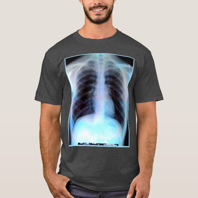 Camisa de la radiografía de Ribcage (Anverso)
