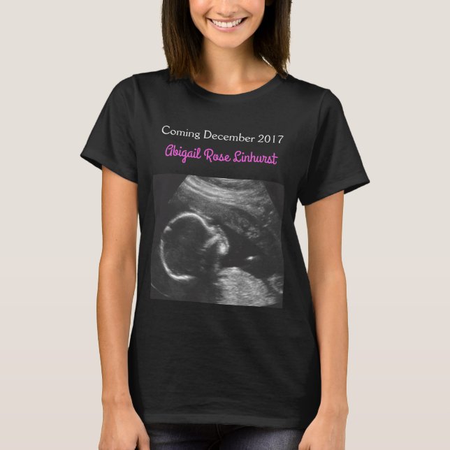 Camisa de maternidad de la imagen del ultrasonido (Anverso)