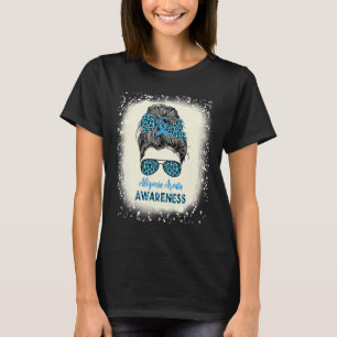Camiseta Alopecia Areata Conciencia Messy bun Pérdida del p