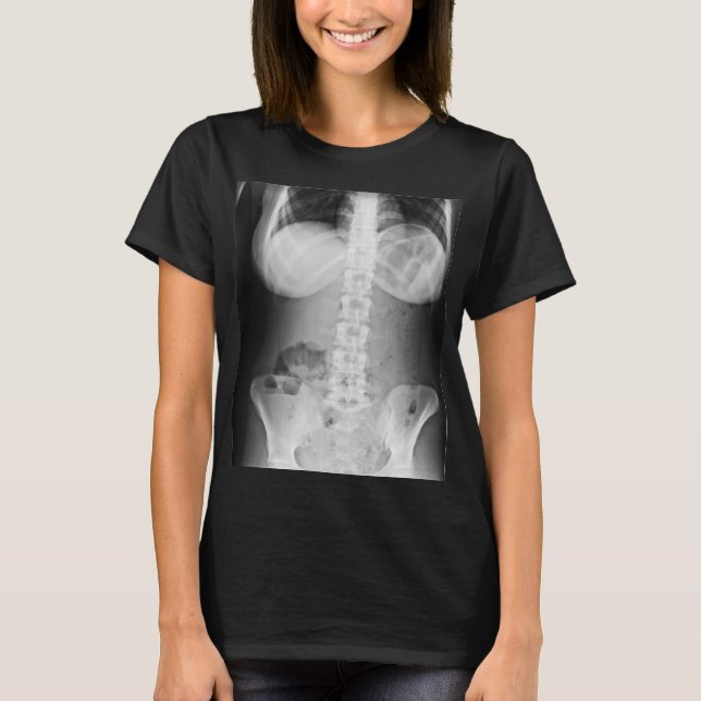 Camiseta Anatomía corporal humana de rayos X médica (Anverso)