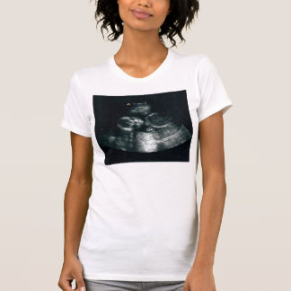 Camiseta Bebé dentro