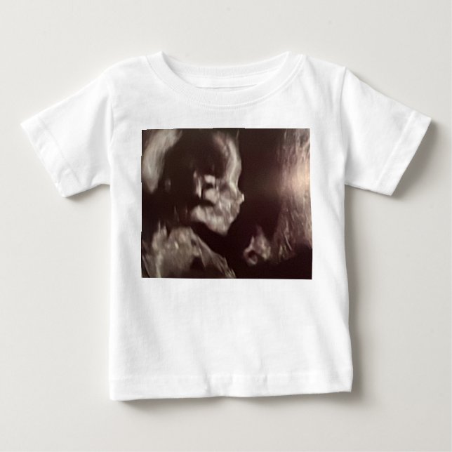 Camiseta De Bebé Entonces, ¿qué piensas? (Anverso)