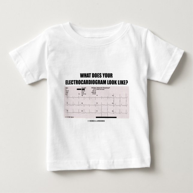 Camiseta De Bebé ¿Qué su electrocardiograma parece? (Anverso)