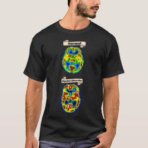 Camiseta de exploración cerebral normal vs bipolar
