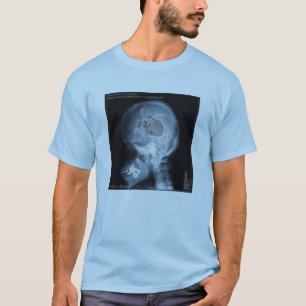 Camiseta Estudio de caso: Batería