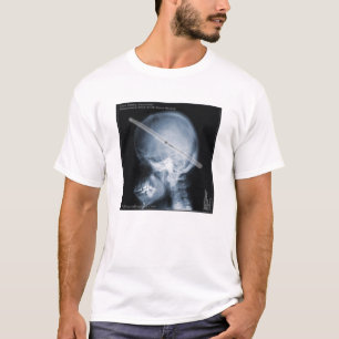 Camiseta Estudio de caso: Batería