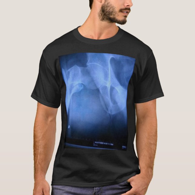 Camiseta fémur quebrado (Anverso)