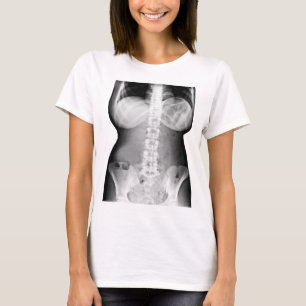 Camiseta Imagen de la foto del Skeleton de Xray Body Femeni