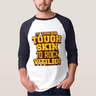 Camiseta Lleva la piel dura el vitiligo de la roca